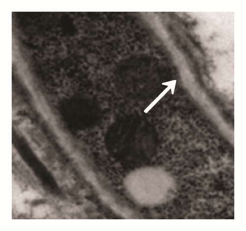 Details are in the caption following the image
