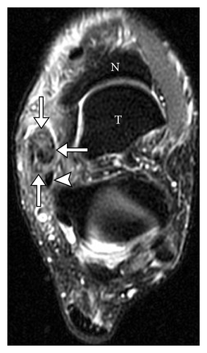 Details are in the caption following the image