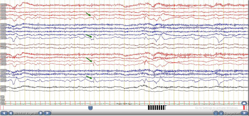 Details are in the caption following the image Details are in the caption following the image