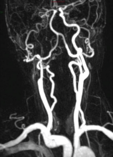 Details are in the caption following the image