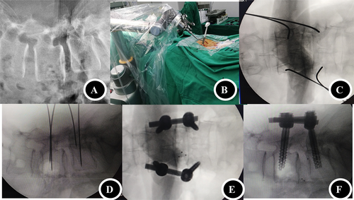 Details are in the caption following the image Details are in the caption following the image