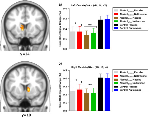 Acute naltrexone does not remediate fronto-striatal disturbances in alcoholic and alcoholic polysubstance-dependent populations during a monetary incentive delay task