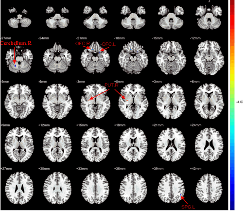 Details are in the caption following the image Details are in the caption following the image