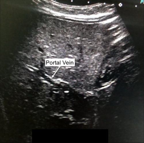 Details are in the caption following the image