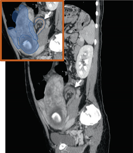 Details are in the caption following the image Details are in the caption following the image