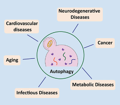 Autophagy in health and disease: From molecular mechanisms to therapeutic target