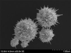 Spherulitic Growth of Gold Particles Precipitated from Aqueous Solution