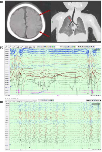 Details are in the caption following the image Details are in the caption following the image