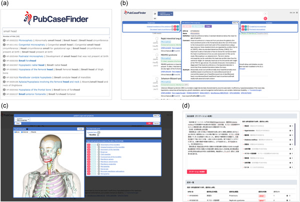 Advances in the development of PubCaseFinder, including the new application programming interface and matching algorithm