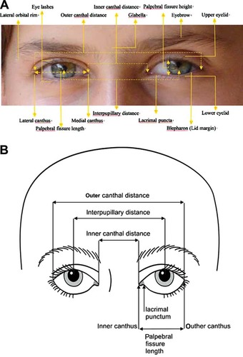 Details are in the caption following the image