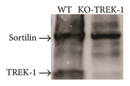 Details are in the caption following the image