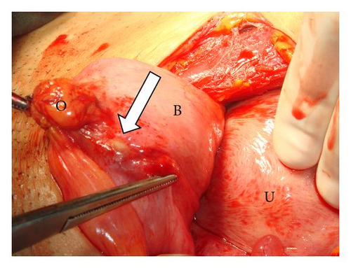 Details are in the caption following the image Details are in the caption following the image