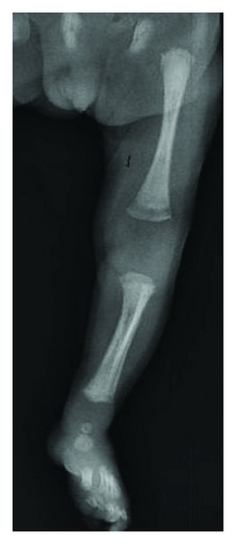 Details are in the caption following the image