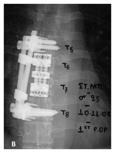 Details are in the caption following the image