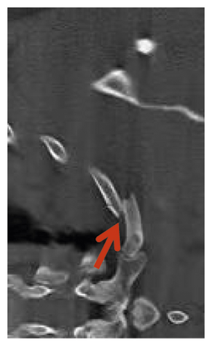 Details are in the caption following the image