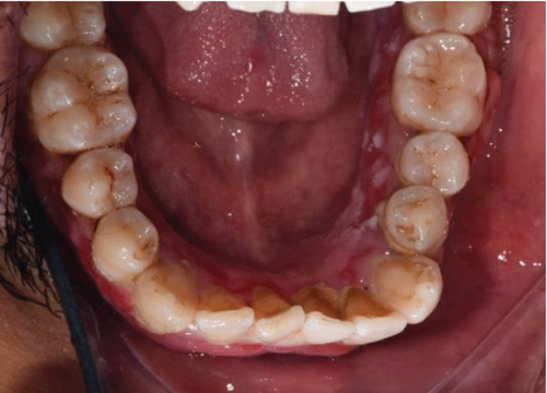 Details are in the caption following the image Details are in the caption following the image