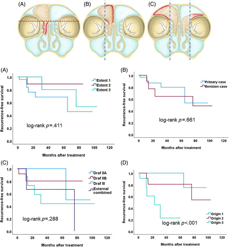 Treatment outcome and prognostic factors of inverted papilloma involving the frontal sinus