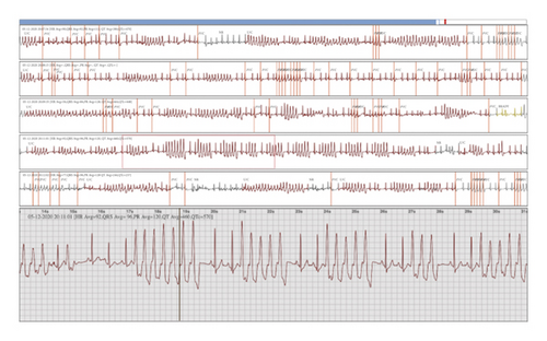 Details are in the caption following the image Details are in the caption following the image