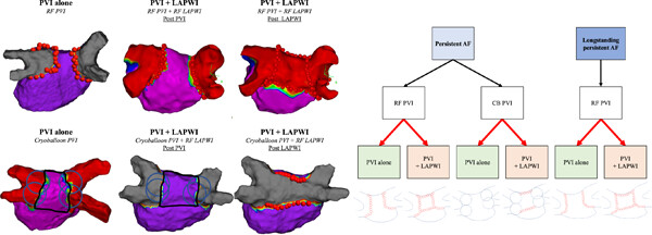 Adjunctive posterior wall isolation for the treatment of persistent and longstanding persistent atrial fibrillation (CORNERSTONE AF) trial: Design and rationale