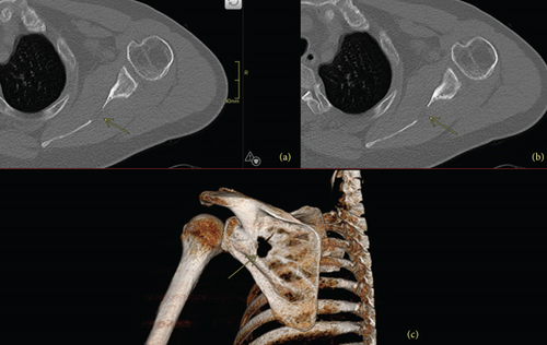 Details are in the caption following the image Details are in the caption following the image