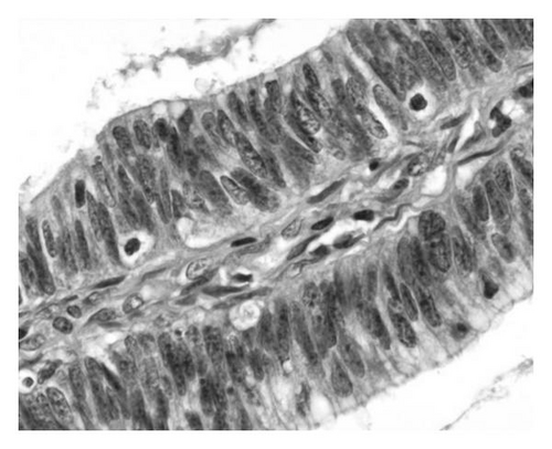 Details are in the caption following the image