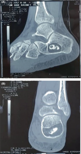Details are in the caption following the image Details are in the caption following the image