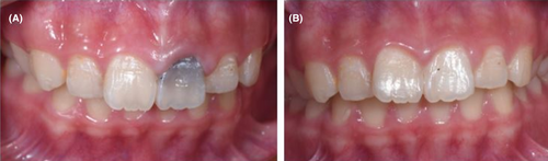 Details are in the caption following the image Details are in the caption following the image