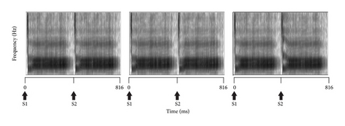 Details are in the caption following the image Details are in the caption following the image