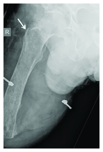 Details are in the caption following the image