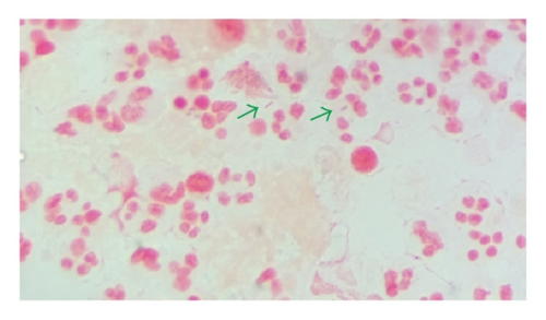 Details are in the caption following the image