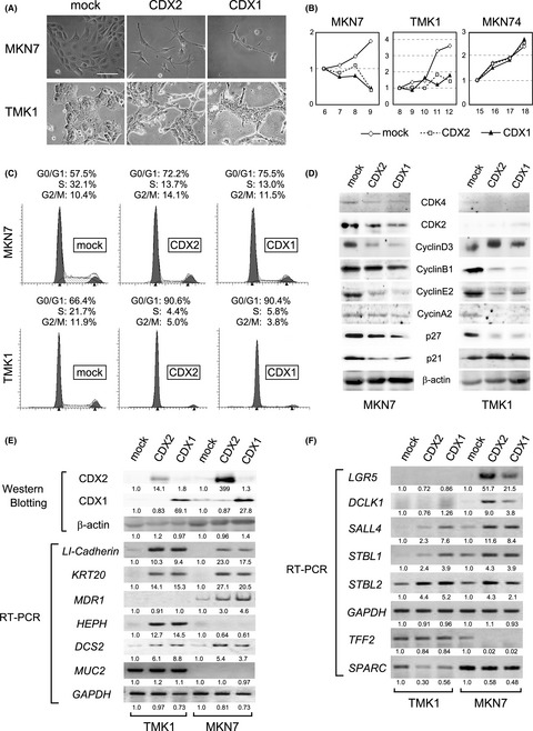 Transduced caudal-type homeobox (CDX) 2/CDX1 can induce growth inhibition on CDX-deficient gastric cancer by rapid intestinal differentiation