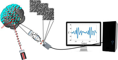 Remote photonic sensing of cerebral hemodynamic changes via temporal spatial analysis of acoustic vibrations