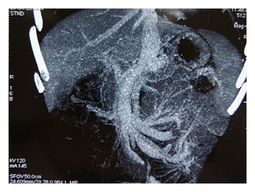 Details are in the caption following the image