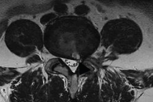 Details are in the caption following the image