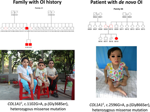 De novo and inherited pathogenic variants in collagen-related osteogenesis imperfecta