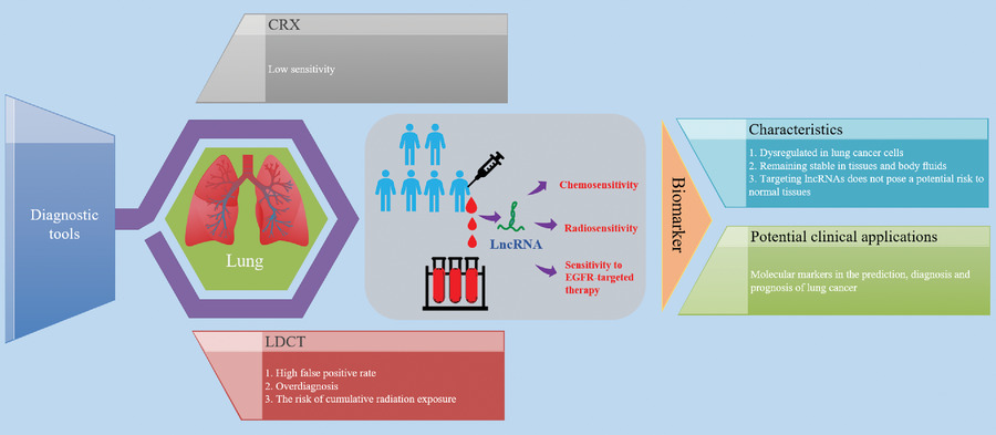 The function of LncRNAs and their role in the prediction, diagnosis, and prognosis of lung cancer