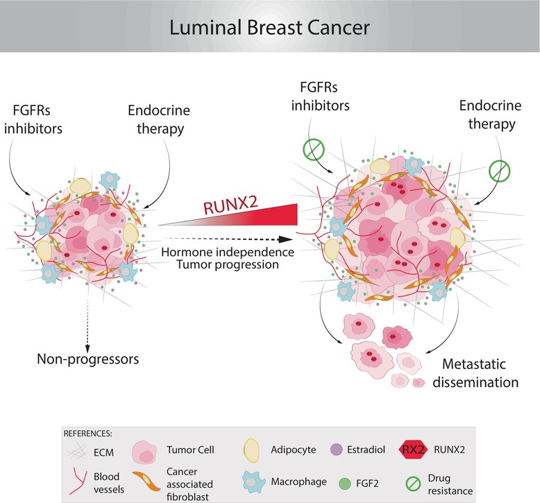 FGFR2-RUNX2 activation: An unexplored therapeutic pathway in luminal breast cancer related to tumor progression
