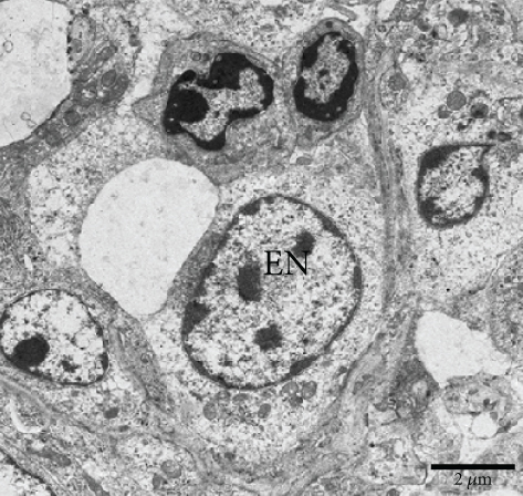 Details are in the caption following the image