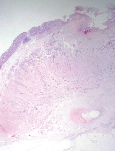 Details are in the caption following the image