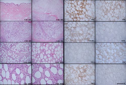 Details are in the caption following the image Details are in the caption following the image