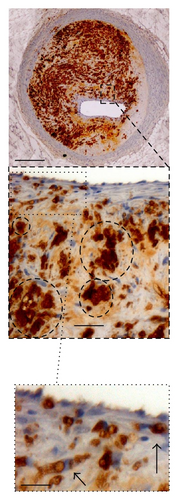 Details are in the caption following the image