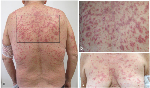 Details are in the caption following the image Details are in the caption following the image