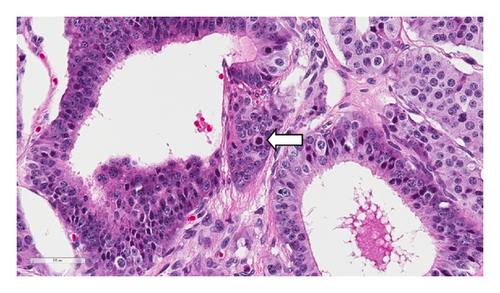 Details are in the caption following the image