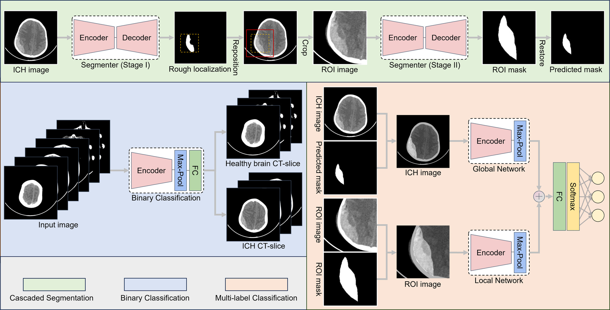 Automated Hematoma Detection and Outcome Prediction in Patients With Traumatic Brain Injury