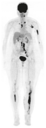 Details are in the caption following the image