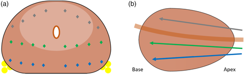 Details are in the caption following the image