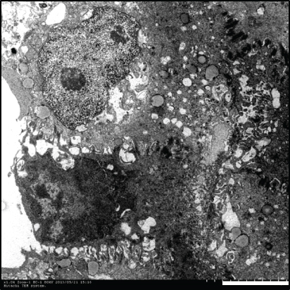 Details are in the caption following the image