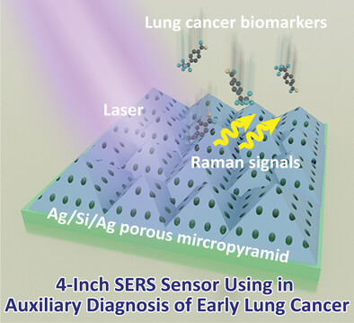 Promising Mass-Productive 4-Inch Commercial SERS Sensor with Particle in Micro-Nano Porous Ag/Si/Ag Structure Using in Auxiliary Diagnosis of Early Lung Cancer