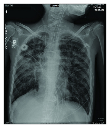 Details are in the caption following the image Details are in the caption following the image