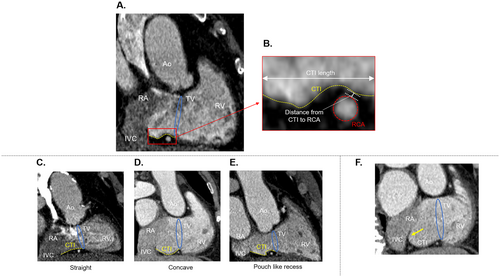 Details are in the caption following the image